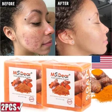 2× Tumeric Soap Skin Whitening Dark Spots lightening Acne Brightening Turmeric
