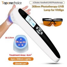 Handheld 308nm UVB Light Therapy Lamp for Face Hand Foot Skin Disorders 20mW/cm 