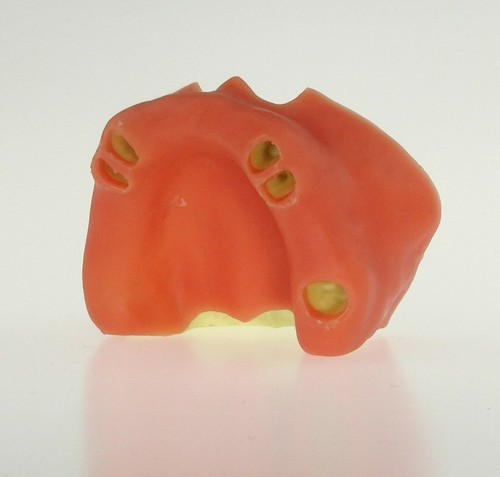 maxillary sinus lifting immediate implant dental training Dentistry model - Picture 5 of 7