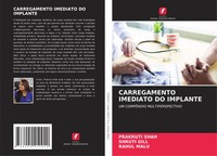 Carregamento Imediato DO Implante UM CompÊNdio Multiperspectivo Shah (U. A.)