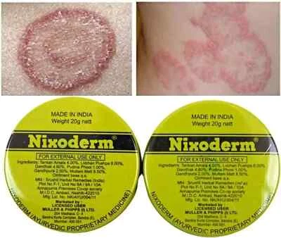 Nixoderm Cream Treats skin infections, eczema, pimples, blemishes, t...