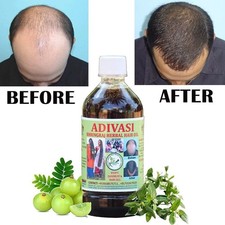 Natural Adivasi Bhringraj Herbal Hair Oil Made With Pure Ayurvedic Herbs - 100ml