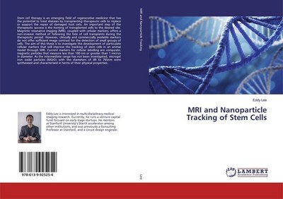 MRI and Nanoparticle Tracking of Stem Cells Eddy Lee