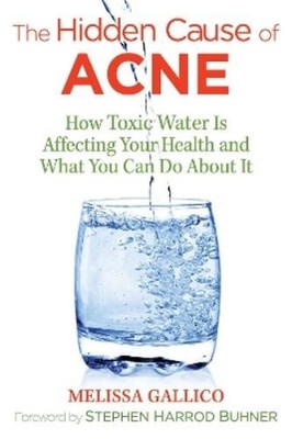 Melissa Gallico The Hidden Cause of Acne (Taschenbuch)