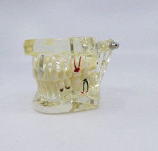 Zahnmodell Schaumodell Unterkiefer Oberkiefer DENTAL ZAHNARZT IMPLANTOLOGIE