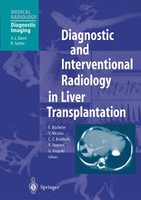 Diagnostic And Interventional Radiology In Liver Transplantation C. E. Broelsch