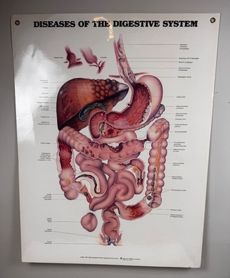 Diseases of the Digestive System Anatomical Chart - Anatomical Chart Company 20x