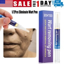 Wart Skin Tag Remover Cream Antibacterial Extract Corn Plaster Wart Ointment US