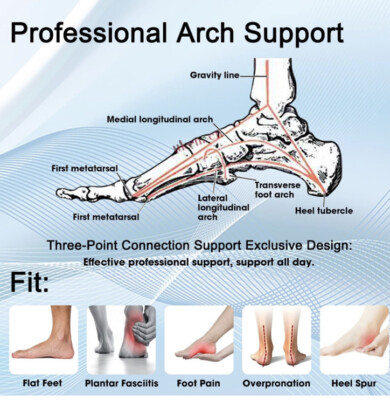 Longitudinal Arch Plantar Fasciitis And Arch Pain Pain In Outer