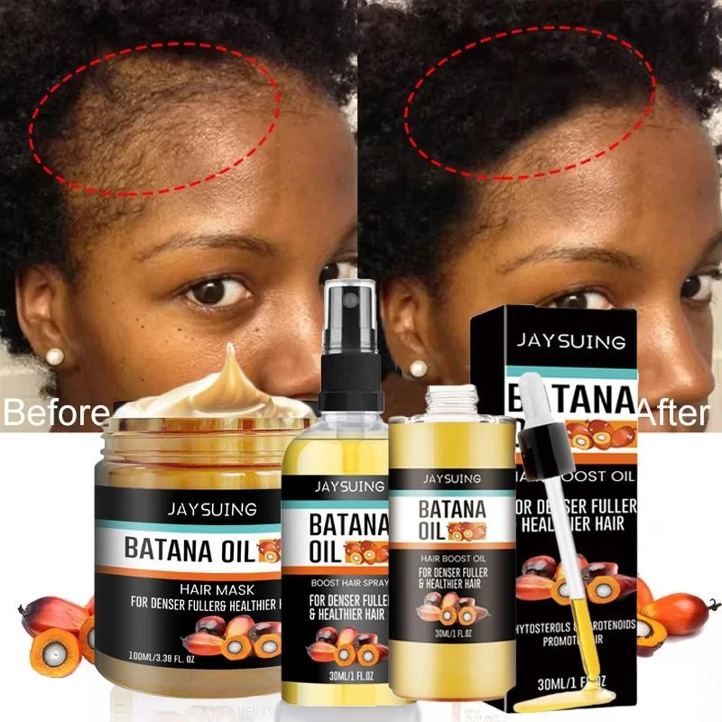 Fast Hair Growth Set Batana Oil Traction Alopecia Anti Break Loss
