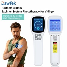 Portable Handheld 308nm UVB Phototherapy Lamp 49 Diodes for Skin Treatment Home