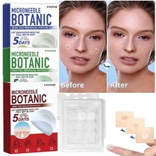 MICRONEEDLE BOTANIC Skin Tag  Acne Patch Skin Tag Remover Patches 9Pcs HOT