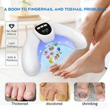 USB Laser Nail Fungus Treatment Device for Toenail  Fingernail