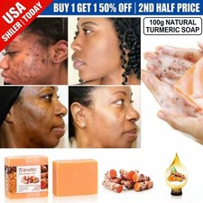 Turmeric Soap Skin Whitening Dark Spots lightening Acne Brightening Natural