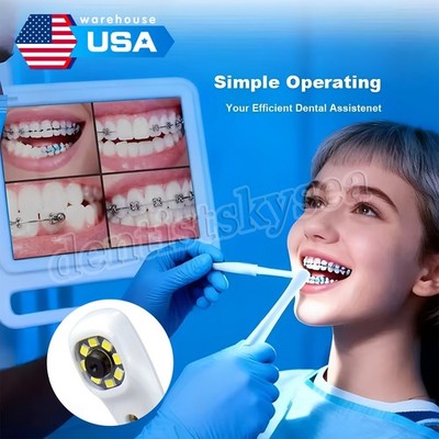 Dental High Definition Digital Intra Oral Endoscope Camera 3IN1 High Definition