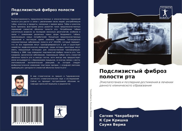 Podslizistyj Fibroz Polosti Rta Sagnik Chakrabarti-image