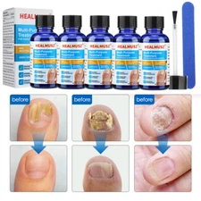 3/5PCS HEALMUSZ Toenail Fungus Treatment for Nail & Fingernails Repair Solution