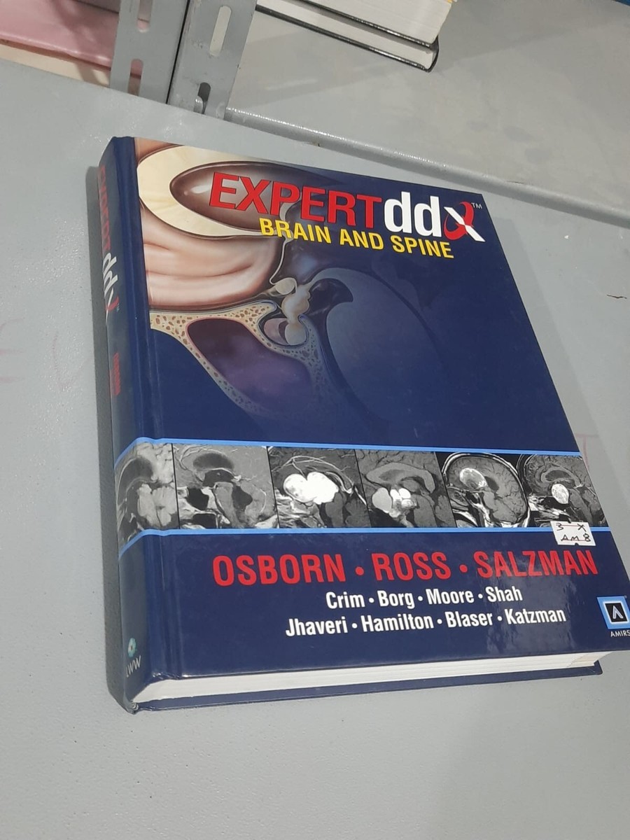 Expertddx (Tm) Ser.: Expert DDX : Brain and Spine by Jeff Ross