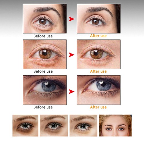 Face Serum Moisturizing Collagen Eye Bags Dark Circles Anti Aging 30ml - Picture 33 of 47