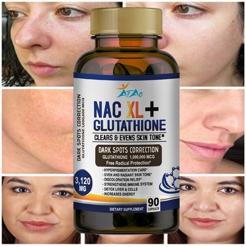 L Glutathione NAC Collagen Skin Whitening Lightening Dark Spots Acne Scar Remova - Picture 1 of 8