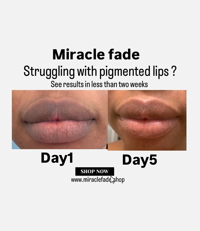 Lip Lightening Cream for Dark Lips|Lip Lightener for Smokers and Non-Smokers - Image 2 of 2