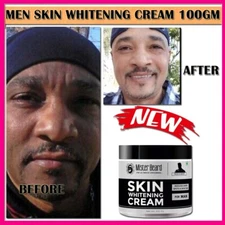 Dark Skin Bleaching Cream Whitening Lightening AHA - Face & Body 100gm