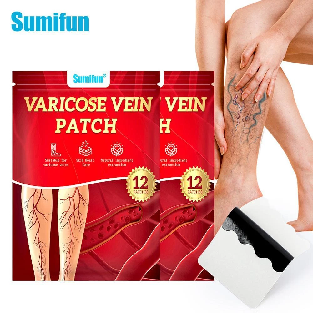 Пластырь для снятия боли при варикозном расширении вен Пластырь для лечения флебита Лечение ног от земляных червей S5 - Изображение 3 из 15