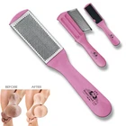 Foot Rasp File Callus Remover Hard Dead Rough Skin Scrubber Dual Sided Pedicure