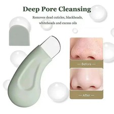Blackhead Remover Whitehead Removal Tool Face Pore Cleaner Skin Lifting Scraper