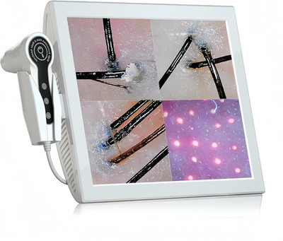 Professional 15-Inch Scalp Camera for Beauty Salons   High-Resolution Hair and S