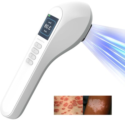 308nm Excimer Light Therapy Device Rechargeable Portable Skin Care UVB Lamp Home