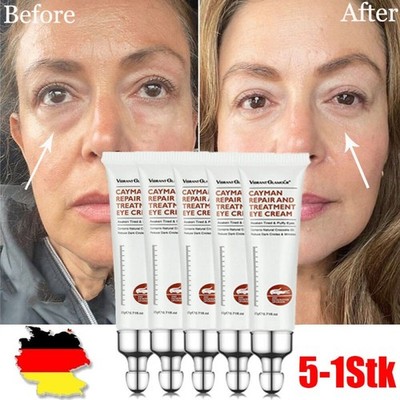 1/2/3/5X Augencreme Eye Cream-28 Sekunden bis gegen Augenringe und Tränensäcke