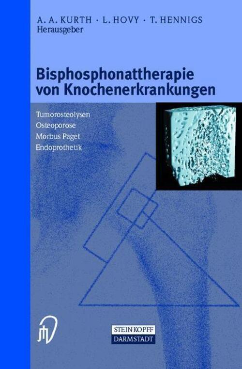 Thumbnail - Bisphosphonattherapie Von Knochenerkrankungen A. A. Kurth (u. A.)