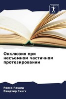 Raisa Rashid (U. A.) | OkklüZiq Pri Nes Emnom Chastichnom Protezirowanii | Buch