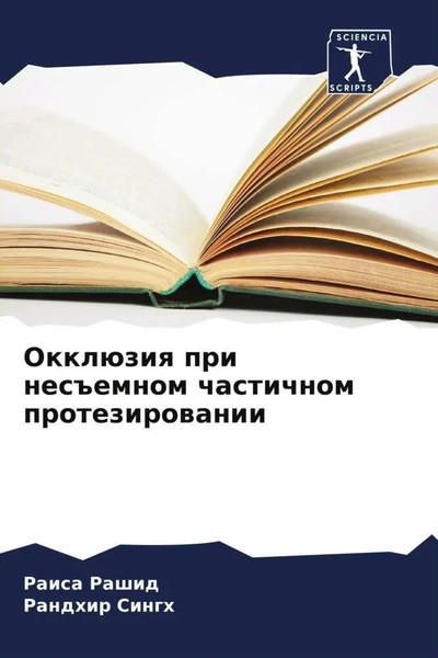 Raisa Rashid (U. A.) | OkklüZiq Pri Nes Emnom Chastichnom Protezirowanii | Buch-image