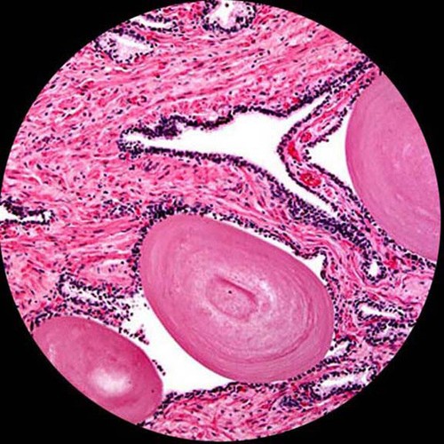 AmScope PS100B 100 PIEZAS Microscopio Preparado Vidrio Diapositivas - Juego B - Imagen 3 de 5
