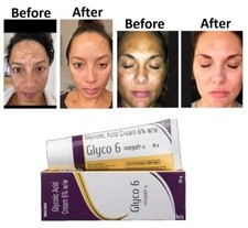 GLYCO 6 Glycolic Acid Cream 6 for Wrinkles, Acne, Acne Scars, Dark Spots 30gms
