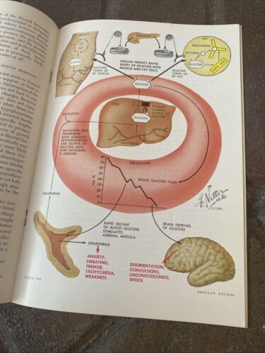 CIBA Clinical Symposia OCTOBER 1963 - DIABETES MELLITUS Rachmiel Levine / Netter - Picture 7 of 13