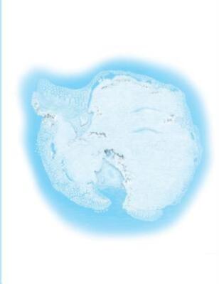 Antarctica
