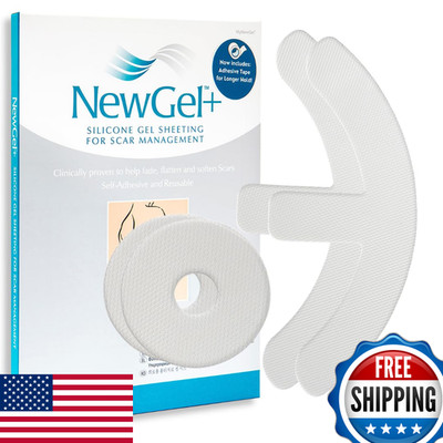 Newgel Advanced Silicone Professional Scar Sheets By Mynewgel Sheeting Set