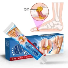 2-Pack Sumifun Bunion and Gout Joint Toe Pain Relief Cream Ointment