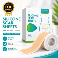 Medical Grade Silicone Scar Sheets, Silicone Scar Tape 1.6  X 60  , Scar Removal