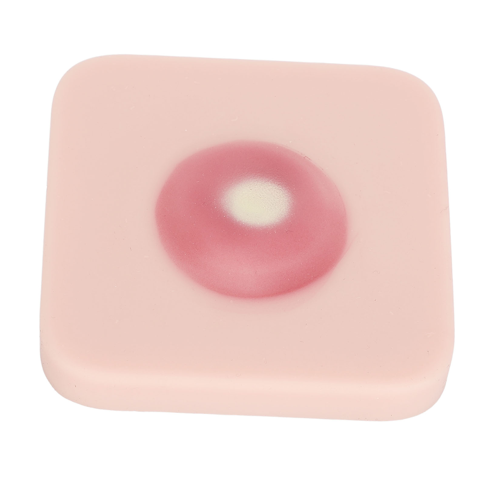 Abszess Inzision Drainage Pad Sebaceous Cyst Surgical Removal Training Haut