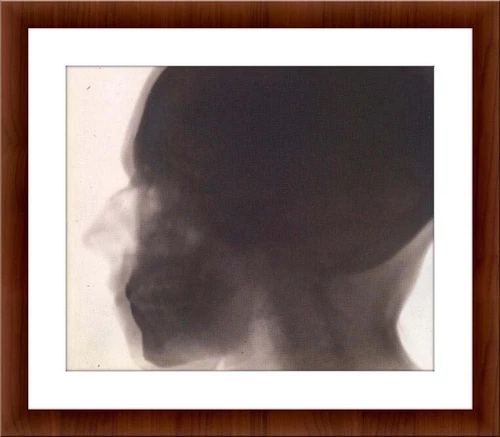 Nikola Tesla Head X Ray Roentgen Ray Photo Wall Art
