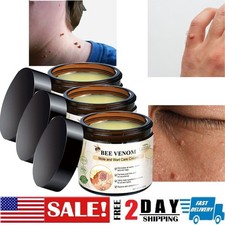 Bee Venom Skin Tag Removal Treatment Cream Body Care Mole Corn Wart Remover