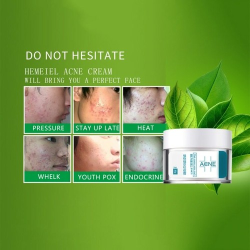 Crema Facial Anti Cicatriz del ACNÉ Granos Espinilla Blanqueadora Dejando POROS - Imagen 5 de 6