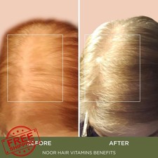 NOOR HAIR Healthy Hair Growth Supplement Fast Regrowth 30 Day