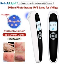 Home Use 308nm UVB Light Handheld 6 Diodes Portable for Skin Wellness Support