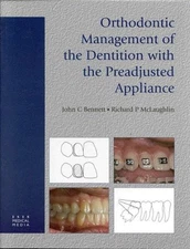 Orthodontic Management of the Dentition with the Preadjusted Appliance - har...