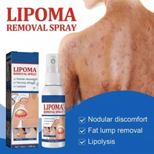 50ML Lipomheilung Reduction Spray, Instant LumpFree Lipoma Removal Spray USA Hot